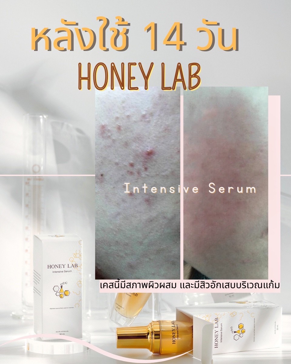 Honeylab Intensive Serum - สกินแคร์ เซรั่ม