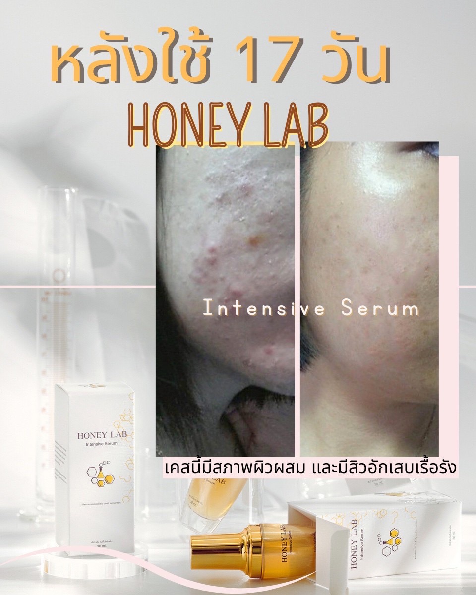 Honeylab Intensive Serum - สกินแคร์ เซรั่ม