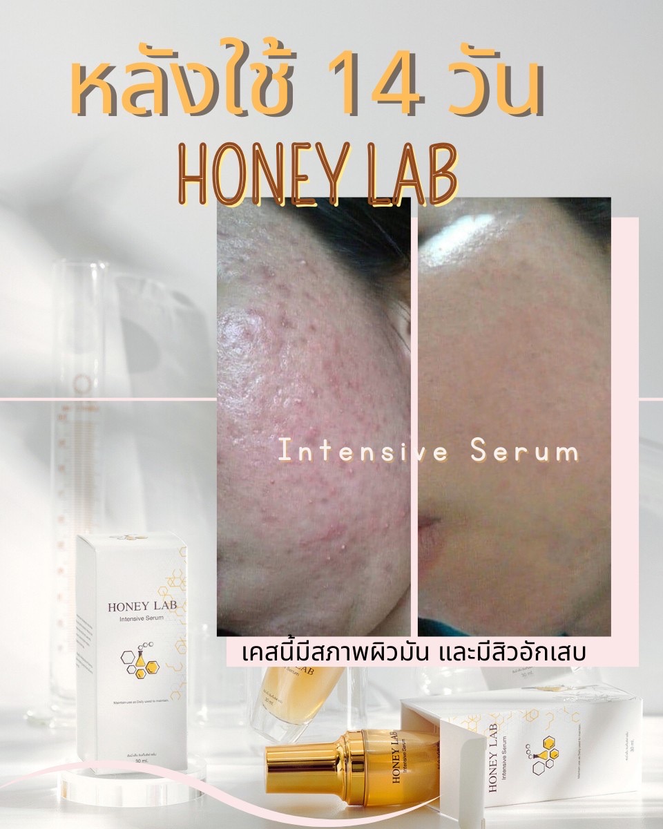 Honeylab Intensive Serum - สกินแคร์ เซรั่ม